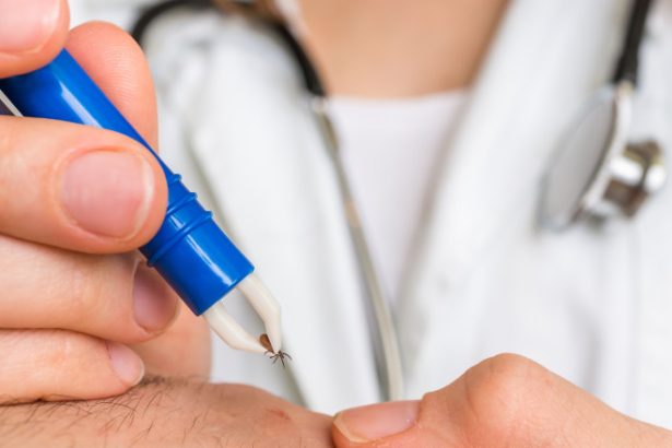 cum scoti corect o capusa si cand trebuie sa mergi la medic avertismentul specialistilor nu se folosesc substante pe piele 68368ae83348b