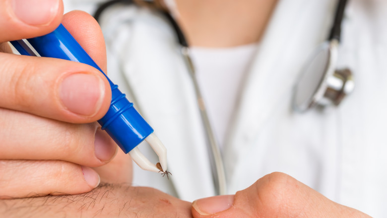 cum scoti corect o capusa si cand trebuie sa mergi la medic avertismentul specialistilor nu se folosesc substante pe piele 68368ae83348b