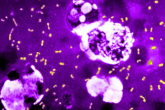 cum a evoluat cea mai letala bacterie din toate timpurile ca sa continue sa omoare milioane de oameni si sa supravietuiasca pana astazi 683e75146269f