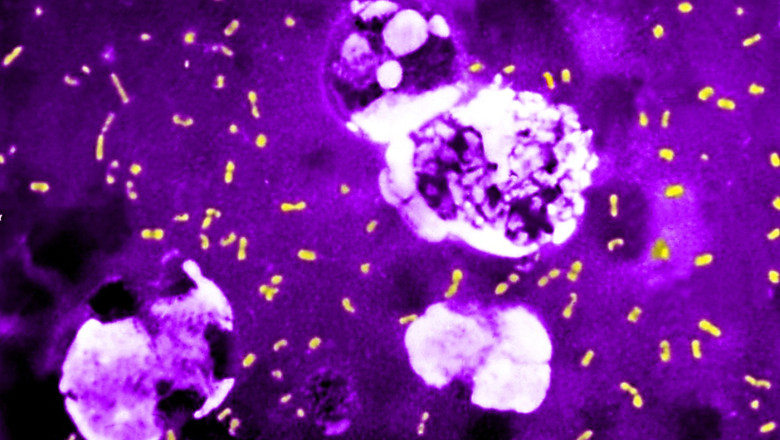 cum a evoluat cea mai letala bacterie din toate timpurile ca sa continue sa omoare milioane de oameni si sa supravietuiasca pana astazi 683e75146269f