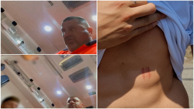 olt un adolescent a fost lovit in ambulanta de un angajat 6847e995c3193