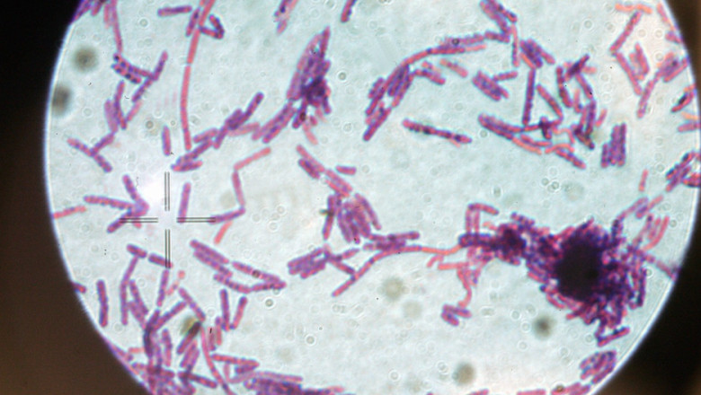 doua cazuri de antrax confirmate in romania 6870158b35ba0
