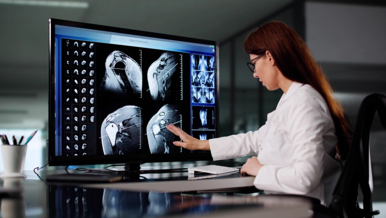 un proiect urias de imagistica medicala va schimba felul in care bolile sunt depistate ce arata imaginile despre consumul de alcool 687f10c8e1e4d