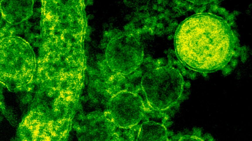 cat de contagioasa este lepra ce spun specialistii 6940053c35aa2