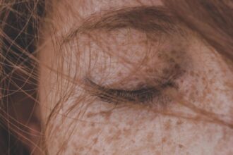 caz iesit din comun intr un spital din romania medicii au extras un vierme de 11 centimetri din pleoapa unei tinere 692d9bc07d5d0