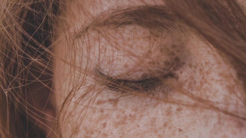 caz iesit din comun intr un spital din romania medicii au extras un vierme de 11 centimetri din pleoapa unei tinere 692d9bc07d5d0