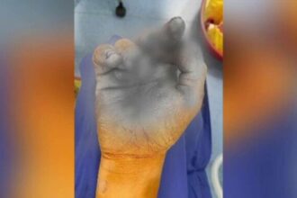 incident in braila doi copii raniti in urma exploziei unei petarde 6941079117ed0