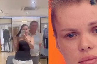 imagini socante cu modelul agresat de iubit tanara de 33 de ani a suferit o interventie pe creier dupa atacul violent 698f8e3912679