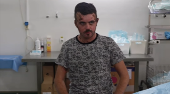 un pacient din barlad cu arsuri la nivelul bratelor gatului si capului spune ca s a nascut a doua oara la spitalul slatina foto 6989f2a47de2f